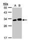 Latexin antibody, PA5-28534, Invitrogen Antibodies, Western Blot image 