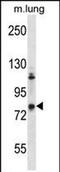 G Protein-Coupled Receptor Kinase 3 antibody, PA5-71917, Invitrogen Antibodies, Western Blot image 