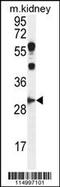 Cyclin G1 antibody, 55-705, ProSci, Western Blot image 