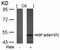 Vasodilator Stimulated Phosphoprotein antibody, GTX38672, GeneTex, Western Blot image 