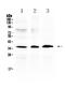 Aldo-Keto Reductase Family 1 Member B10 antibody, PA5-78751, Invitrogen Antibodies, Western Blot image 