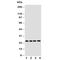 Lactalbumin Alpha antibody, R30797, NSJ Bioreagents, Western Blot image 