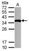 NME/NM23 Family Member 9 antibody, LS-C155499, Lifespan Biosciences, Western Blot image 