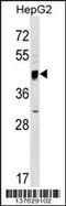 Serine Incorporator 2 antibody, 59-321, ProSci, Western Blot image 