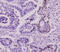 Small Ubiquitin Like Modifier 2 antibody, MBS200184, MyBioSource, Immunohistochemistry paraffin image 