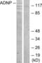 Activity Dependent Neuroprotector Homeobox antibody, LS-C119261, Lifespan Biosciences, Western Blot image 
