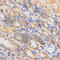 Integrin Subunit Beta 5 antibody, A2497, ABclonal Technology, Immunohistochemistry paraffin image 