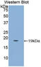 Placental Growth Factor antibody, MBS2028765, MyBioSource, Western Blot image 