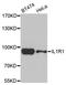 Interleukin 1 Receptor Type 1 antibody, A5727, ABclonal Technology, Western Blot image 