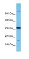 Odorant Binding Protein 2B antibody, orb327039, Biorbyt, Western Blot image 