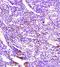 Extracellular Matrix Protein 1 antibody, orb10578, Biorbyt, Immunohistochemistry paraffin image 