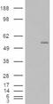 Glucosaminyl (N-Acetyl) Transferase 3, Mucin Type antibody, EB08256, Everest Biotech, Western Blot image 