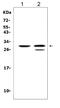 Kallikrein 1 antibody, PA1625, Boster Biological Technology, Western Blot image 