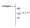 Collagen Type I Alpha 1 Chain antibody, PA5-35379, Invitrogen Antibodies, Western Blot image 