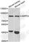 Adenosine Monophosphate Deaminase 3 antibody, A6354, ABclonal Technology, Western Blot image 