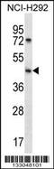 Sphingosine-1-Phosphate Phosphatase 1 antibody, 56-932, ProSci, Western Blot image 