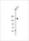 Activity Dependent Neuroprotector Homeobox antibody, 59-817, ProSci, Western Blot image 
