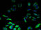 Transmembrane Protein 217 antibody, A61398-100, Epigentek, Immunofluorescence image 