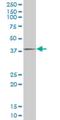 Four And A Half LIM Domains 1 antibody, H00002273-M05, Novus Biologicals, Western Blot image 