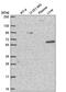 Non-SMC Condensin II Complex Subunit H2 antibody, PA5-66964, Invitrogen Antibodies, Western Blot image 