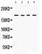 Hexokinase Domain Containing 1 antibody, PA5-79365, Invitrogen Antibodies, Western Blot image 