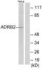 Adrenoceptor Beta 2 antibody, LS-C119383, Lifespan Biosciences, Western Blot image 