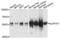 Aldehyde Dehydrogenase 7 Family Member A1 antibody, LS-C410163, Lifespan Biosciences, Western Blot image 