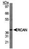 Regulator Of Calcineurin 1 antibody, PA5-23028, Invitrogen Antibodies, Western Blot image 