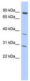 Kelch Like Family Member 5 antibody, TA345188, Origene, Western Blot image 