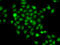 COP9 Signalosome Subunit 2 antibody, 22-649, ProSci, Immunofluorescence image 