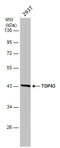 TAR DNA Binding Protein antibody, GTX633973, GeneTex, Western Blot image 