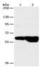 G Protein-Coupled Receptor Kinase 4 antibody, orb107390, Biorbyt, Western Blot image 