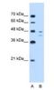 Fumarylacetoacetate Hydrolase antibody, NBP1-53110, Novus Biologicals, Western Blot image 