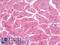 CD59 Molecule (CD59 Blood Group) antibody, LS-B9608, Lifespan Biosciences, Immunohistochemistry paraffin image 