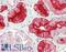 CD224 antibody, LS-B11193, Lifespan Biosciences, Immunohistochemistry paraffin image 