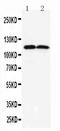 Anoctamin 1 antibody, LS-C313382, Lifespan Biosciences, Western Blot image 