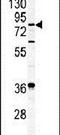 Acylaminoacyl-Peptide Hydrolase antibody, PA5-11354, Invitrogen Antibodies, Western Blot image 