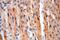 Mitochondrial Trans-2-Enoyl-CoA Reductase antibody, 14932-1-AP, Proteintech Group, Immunohistochemistry paraffin image 