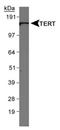 Telomerase Reverse Transcriptase antibody, NB110-89471, Novus Biologicals, Western Blot image 