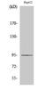 Ephrin A4 antibody, STJ92957, St John