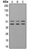 Glycogen Synthase Kinase 3 Alpha antibody, LS-C353994, Lifespan Biosciences, Western Blot image 