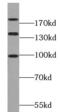Par-3 Family Cell Polarity Regulator antibody, FNab06146, FineTest, Western Blot image 