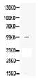 Matrix Metallopeptidase 12 antibody, PA5-79679, Invitrogen Antibodies, Western Blot image 