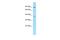 Protein Phosphatase 1 Regulatory Subunit 12C antibody, A09178, Boster Biological Technology, Western Blot image 