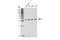 Growth Differentiation Factor 15 antibody, 3249S, Cell Signaling Technology, Western Blot image 