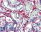 Clathrin Heavy Chain antibody, LS-B15476, Lifespan Biosciences, Immunohistochemistry paraffin image 