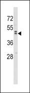 Wnt Family Member 10B antibody, PA5-72461, Invitrogen Antibodies, Western Blot image 