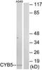 Cytochrome B5 Type A antibody, TA311701, Origene, Western Blot image 