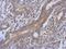 tRNA dimethylallyltransferase, mitochondrial antibody, GTX120508, GeneTex, Immunohistochemistry paraffin image 