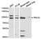 Protein Kinase C Epsilon antibody, LS-C192873, Lifespan Biosciences, Western Blot image 